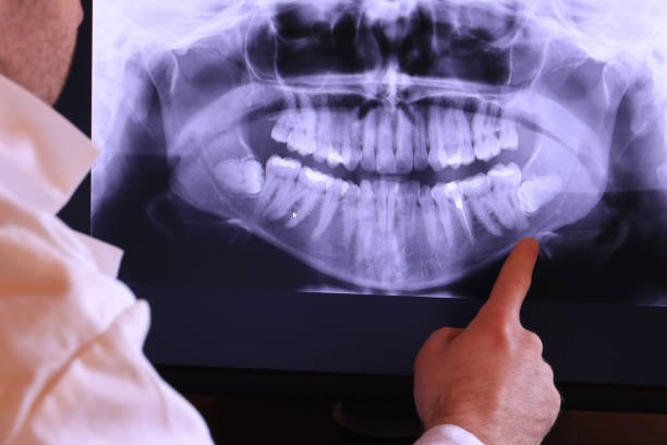Best Emergency Treatment for Toothache in Waverly, NE